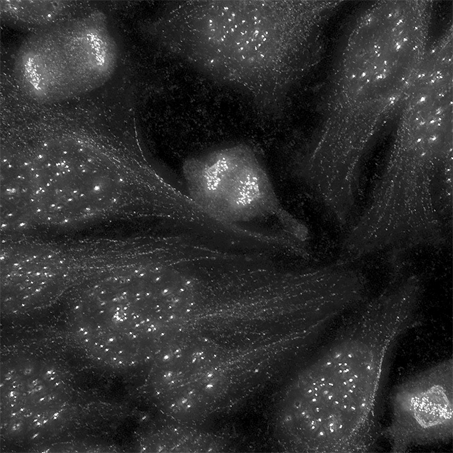 clusters of cells as seen through a microscope